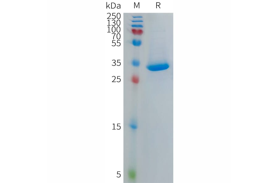 SDS-PAGE - Recombinant Human CXCL4L1 Protein (Fc Tag) (A317696) - Antibodies.com