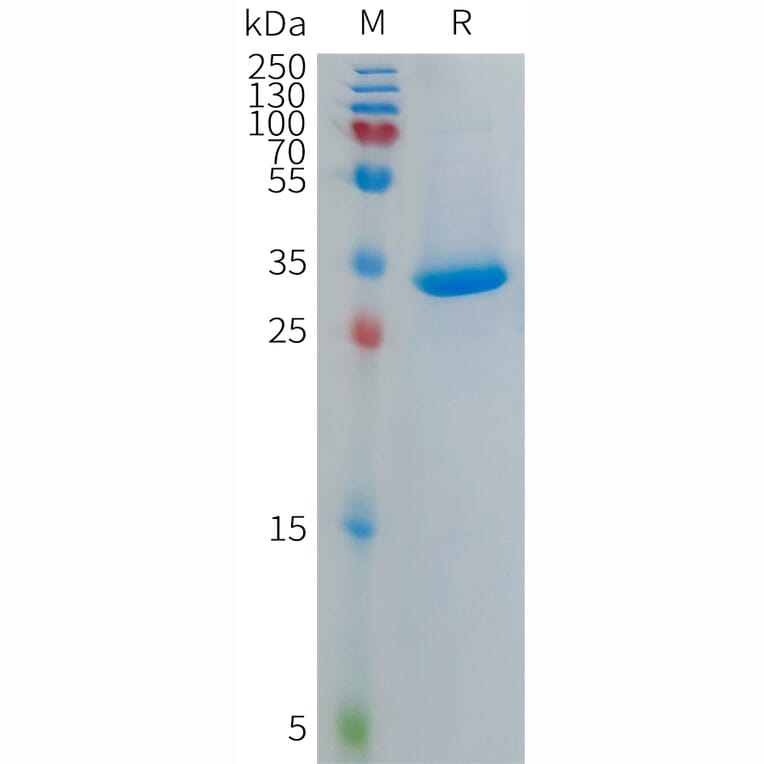 SDS-PAGE - Recombinant Human CXCL4L1 Protein (Fc Tag) (A317696) - Antibodies.com