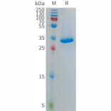 SDS-PAGE - Recombinant Human CXCL4L1 Protein (Fc Tag) (A317696) - Antibodies.com