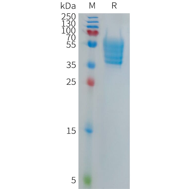 SDS-PAGE - Recombinant Human ECSCR Protein (Fc Tag) (A317697) - Antibodies.com