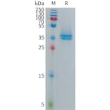 SDS-PAGE - Recombinant Human TAFA5 Protein (Fc Tag) (A317698) - Antibodies.com