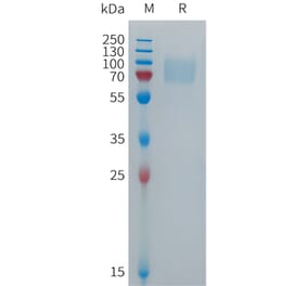 SDS-PAGE - Recombinant Human CD16b Protein (Fc Tag) (A317699) - Antibodies.com