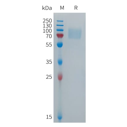 SDS-PAGE - Recombinant Human CD16b Protein (Fc Tag) (A317699) - Antibodies.com