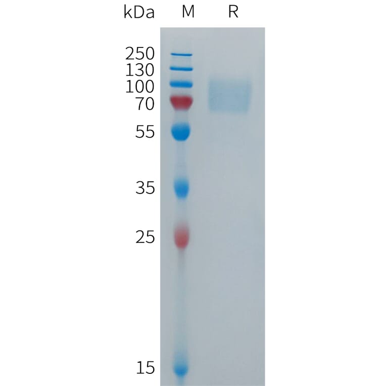 SDS-PAGE - Recombinant Human CD16b Protein (Fc Tag) (A317699) - Antibodies.com