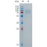 SDS-PAGE - Recombinant Human CD16b Protein (Fc Tag) (A317699) - Antibodies.com