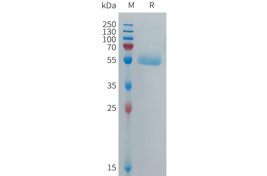 SDS-PAGE - Recombinant Human CPM Protein (6×His Tag) (A317701) - Antibodies.com