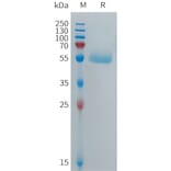 SDS-PAGE - Recombinant Human CPM Protein (6×His Tag) (A317701) - Antibodies.com