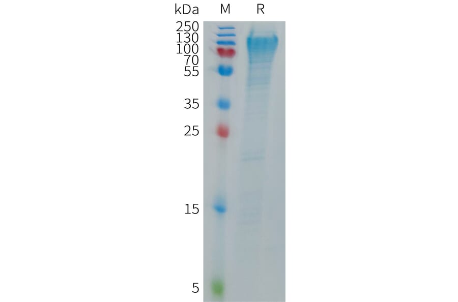 SDS-PAGE - Recombinant Human MANSC1 Protein (6×His Tag) (A317702) - Antibodies.com