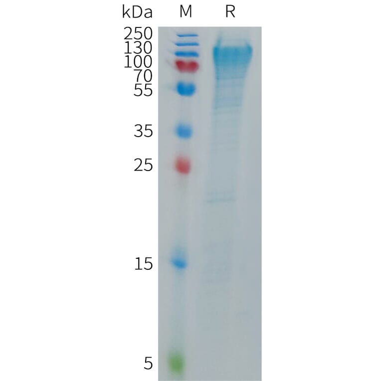 SDS-PAGE - Recombinant Human MANSC1 Protein (6×His Tag) (A317702) - Antibodies.com