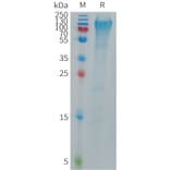 SDS-PAGE - Recombinant Human MANSC1 Protein (6×His Tag) (A317702) - Antibodies.com
