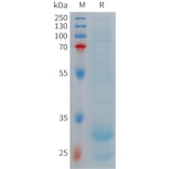 SDS-PAGE - Recombinant Human Hepcidin-25 Protein (Fc Tag) (A317705) - Antibodies.com