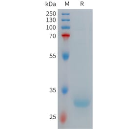 SDS-PAGE - Recombinant Human Hepcidin-20 Protein (Fc Tag) (A317706) - Antibodies.com