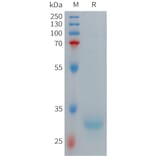 SDS-PAGE - Recombinant Human Hepcidin-20 Protein (Fc Tag) (A317706) - Antibodies.com