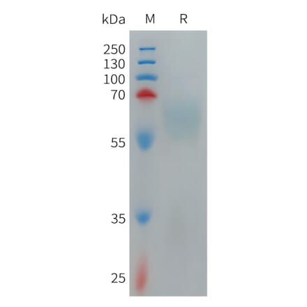 SDS-PAGE - Recombinant Human TMEM219 Protein (Fc Tag) (A317707) - Antibodies.com