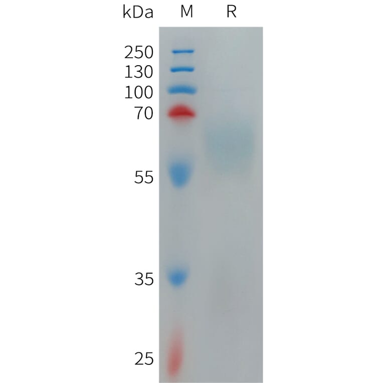 SDS-PAGE - Recombinant Human TMEM219 Protein (Fc Tag) (A317707) - Antibodies.com