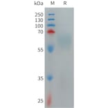 SDS-PAGE - Recombinant Human TMEM219 Protein (Fc Tag) (A317707) - Antibodies.com