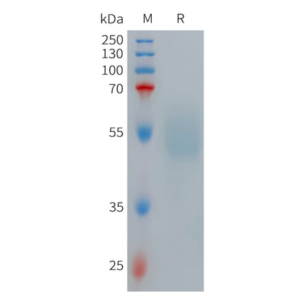 SDS-PAGE - Recombinant Human GLP-1R Protein (Fc Tag) (A317708) - Antibodies.com