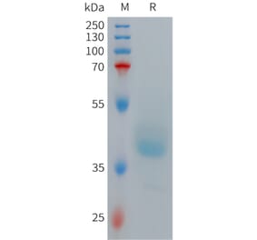 SDS-PAGE - Recombinant Human GRPR Protein (Fc Tag) (A317709) - Antibodies.com