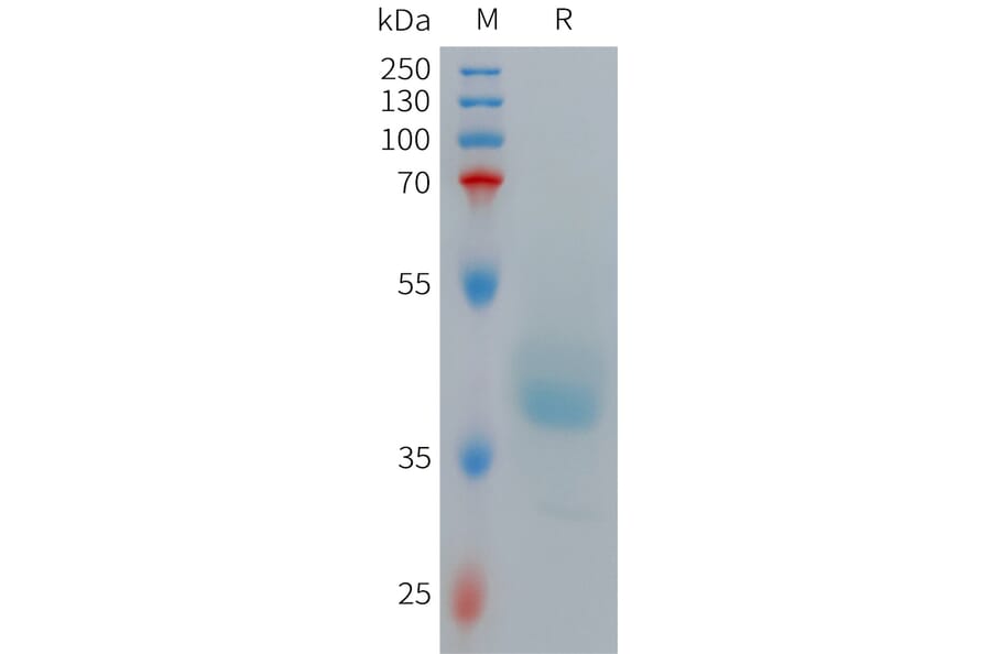 SDS-PAGE - Recombinant Human GRPR Protein (Fc Tag) (A317709) - Antibodies.com