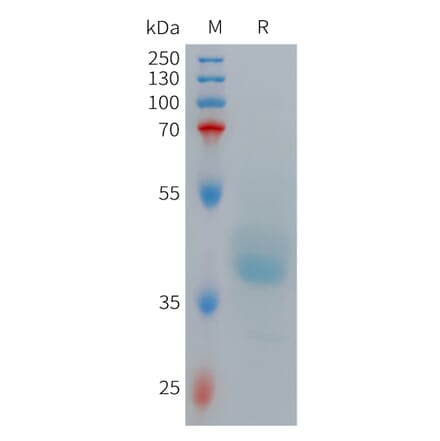 SDS-PAGE - Recombinant Human GRPR Protein (Fc Tag) (A317709) - Antibodies.com