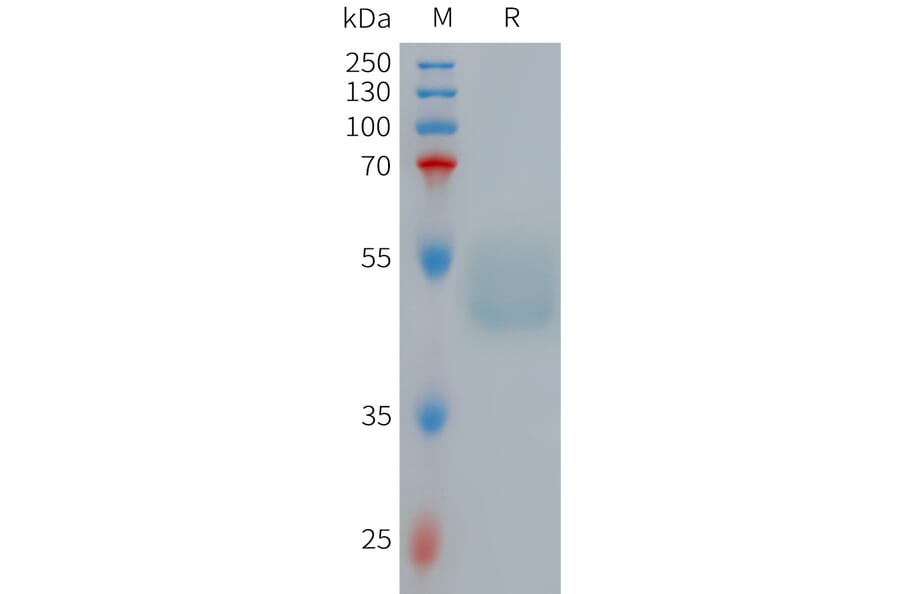 SDS-PAGE - Recombinant Human GIPR Protein (Fc Tag) (A317710) - Antibodies.com
