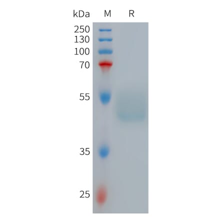 SDS-PAGE - Recombinant Human GIPR Protein (Fc Tag) (A317710) - Antibodies.com