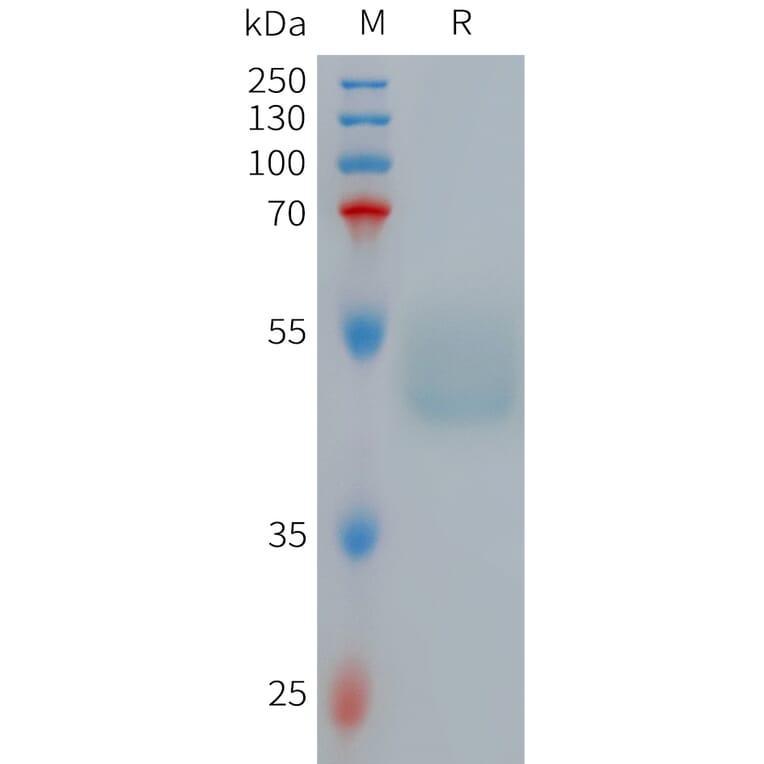 SDS-PAGE - Recombinant Human GIPR Protein (Fc Tag) (A317710) - Antibodies.com