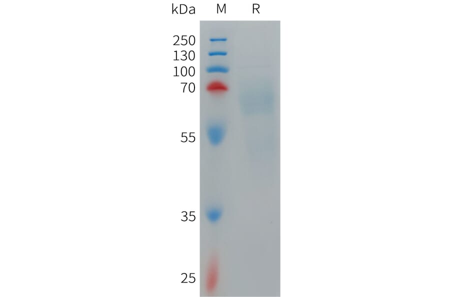 SDS-PAGE - Recombinant Human IL-12A Protein (Fc Tag) + IL-12B Protein (6×His Tag) Heterodimer (A317711) - Antibodies.com