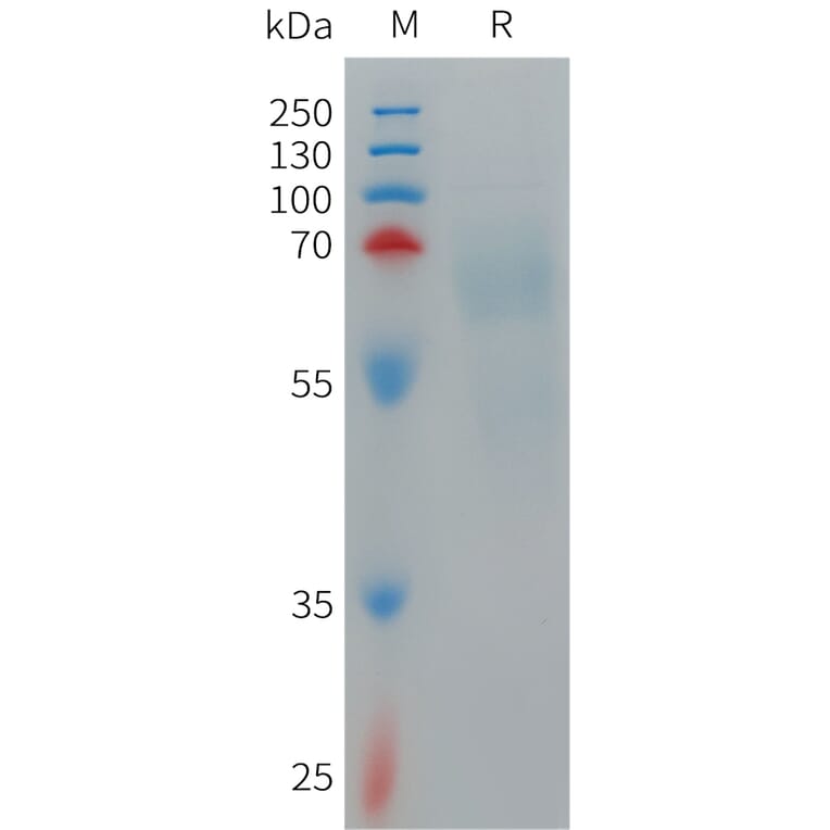 SDS-PAGE - Recombinant Human IL-12A Protein (Fc Tag) + IL-12B Protein (6×His Tag) Heterodimer (A317711) - Antibodies.com