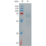 SDS-PAGE - Recombinant Human IL-12A Protein (Fc Tag) + IL-12B Protein (6×His Tag) Heterodimer (A317711) - Antibodies.com