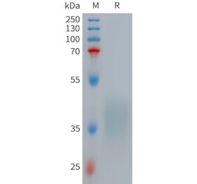 SDS-PAGE - Recombinant Human TNF Receptor II Protein (6×His Tag) (A317712) - Antibodies.com