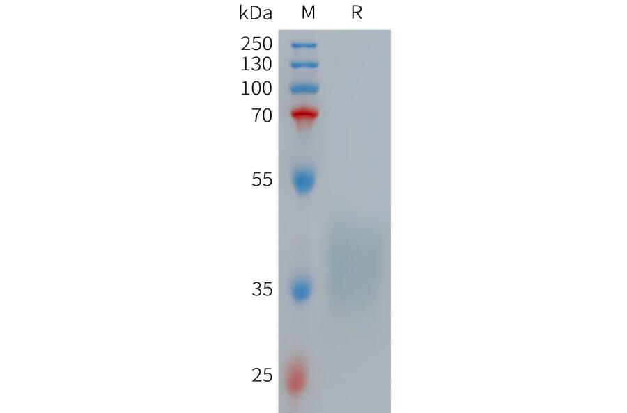 SDS-PAGE - Recombinant Human TNF Receptor II Protein (6×His Tag) (A317712) - Antibodies.com