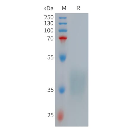 SDS-PAGE - Recombinant Human TNF Receptor II Protein (6×His Tag) (A317712) - Antibodies.com