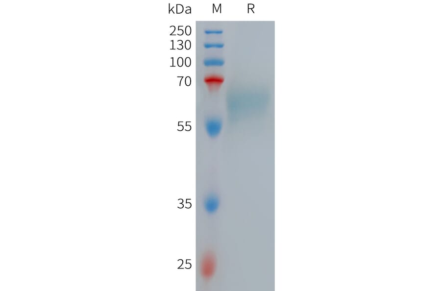 SDS-PAGE - Recombinant Human Low-density Lipoprotein Receptor-related Protein 10 (6×His Tag) (A317713) - Antibodies.com