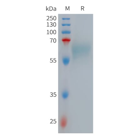 SDS-PAGE - Recombinant Human Low-density Lipoprotein Receptor-related Protein 10 (6×His Tag) (A317713) - Antibodies.com