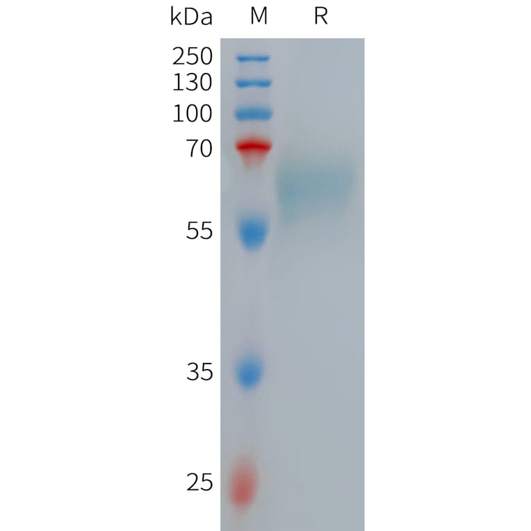 SDS-PAGE - Recombinant Human Low-density Lipoprotein Receptor-related Protein 10 (6×His Tag) (A317713) - Antibodies.com