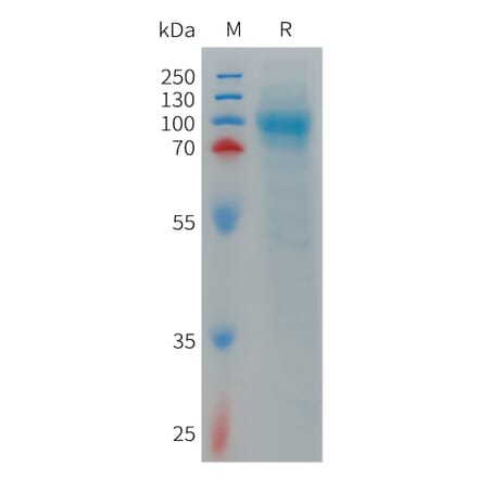 SDS-PAGE - Recombinant Human LRRN1 Protein (6×His Tag) (A317714) - Antibodies.com