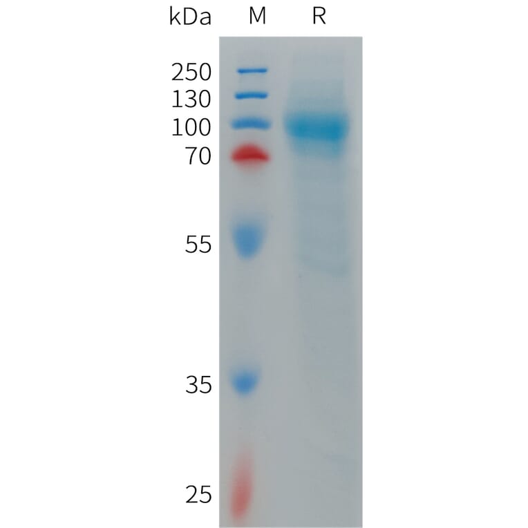 SDS-PAGE - Recombinant Human LRRN1 Protein (6×His Tag) (A317714) - Antibodies.com