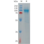 SDS-PAGE - Recombinant Human LRRN1 Protein (6×His Tag) (A317714) - Antibodies.com
