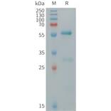 SDS-PAGE - Recombinant Human CLECSF6 Protein (Fc Tag) (A317715) - Antibodies.com