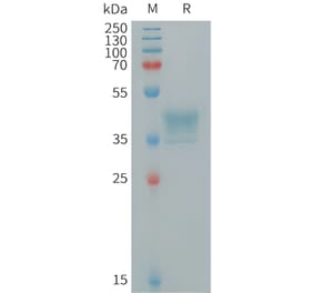 SDS-PAGE - Recombinant Human GPCR MRGX2 Protein (Fc Tag) (A317716) - Antibodies.com