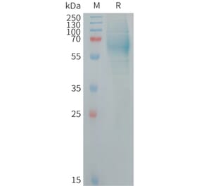 SDS-PAGE - Recombinant Human IgHE Protein (6×His Tag) (A317717) - Antibodies.com