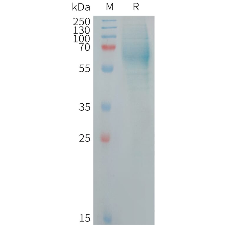 SDS-PAGE - Recombinant Human IgHE Protein (6×His Tag) (A317717) - Antibodies.com