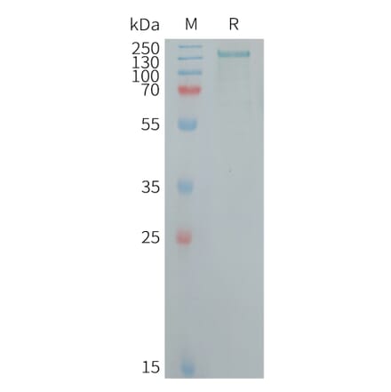 SDS-PAGE - Recombinant Human CD109 Protein (6×His Tag) (A317718) - Antibodies.com