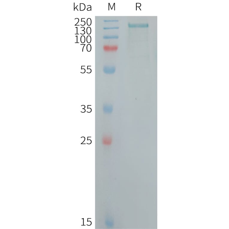 SDS-PAGE - Recombinant Human CD109 Protein (6×His Tag) (A317718) - Antibodies.com