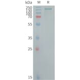 SDS-PAGE - Recombinant Human CD109 Protein (6×His Tag) (A317718) - Antibodies.com
