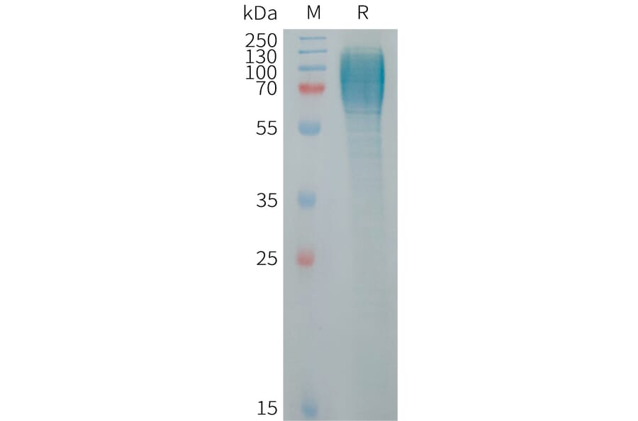 SDS-PAGE - Recombinant Human ICAM3 Protein (6×His Tag) (A317720) - Antibodies.com