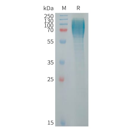 SDS-PAGE - Recombinant Human ICAM3 Protein (6×His Tag) (A317720) - Antibodies.com