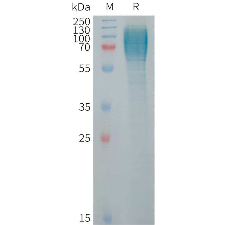 SDS-PAGE - Recombinant Human ICAM3 Protein (6×His Tag) (A317720) - Antibodies.com