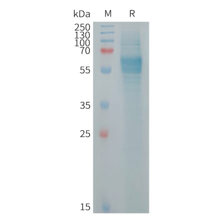 SDS-PAGE - Recombinant human FcRL2 Protein (6×His Tag) (A317721) - Antibodies.com